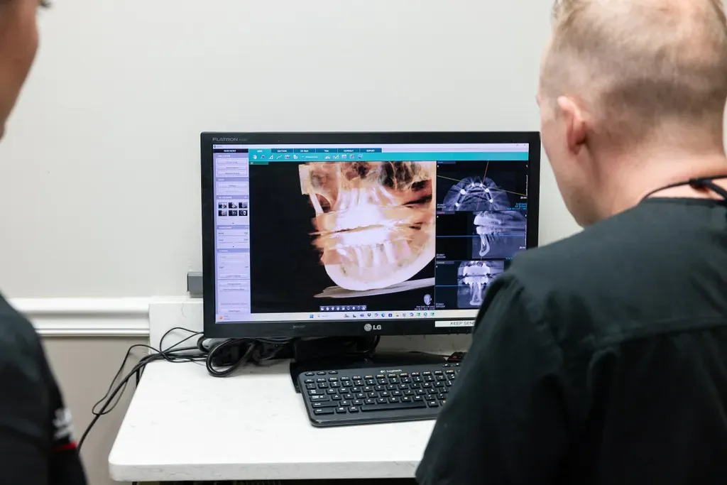 Complementary Consultation with 3D X-rays for All on X, Full Mouth Reconstruction and Implants.